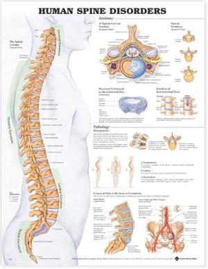 Image of CHART 9970 HUMAN SPINE DISORDERS LAM.